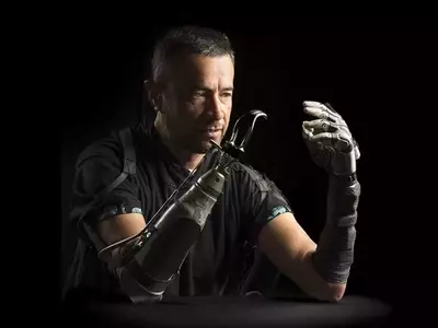 Bridging the Gap: AI Enhances Bionic Hand Functionality for Amputees