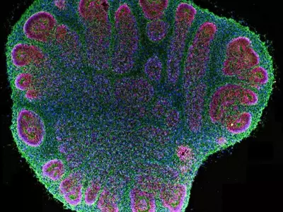 Brain Organoids: Advancements and Ethical Complexities in Neural Research