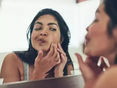 Understanding and Managing Postpartum Acne