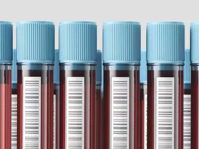 Direct-to-Consumer Blood Testing: Empowerment or Peril?
