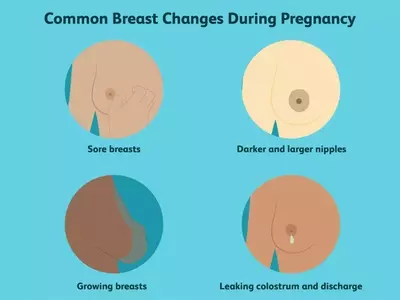 Understanding Breast Transformations During Pregnancy: A Comprehensive Guide
