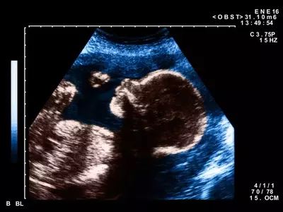 The Art and Impact of Pregnancy Nicknames