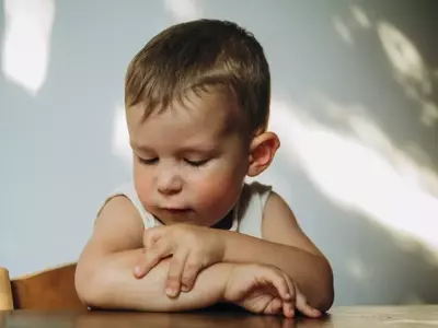 Understanding and Managing Eczema in Children