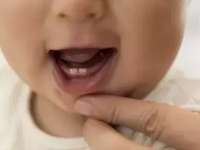 Baby Teeth: Untangling the Impact of Toxic Metals on Brain Development