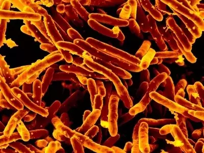 Revolutionizing Tuberculosis Diagnostics: A New Era of Swift and Accurate Detection