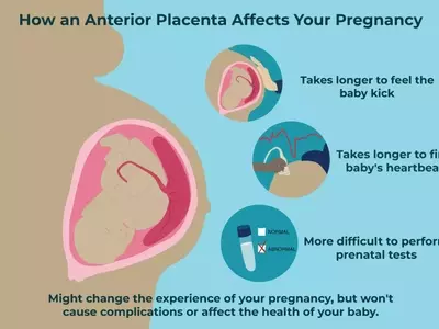 Understanding Anterior Placenta During Pregnancy
