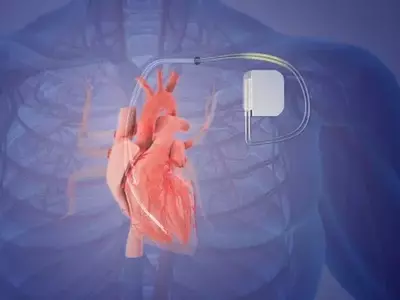 Orchestra BioMed: A Promising Horizon in Medical Device Innovation
