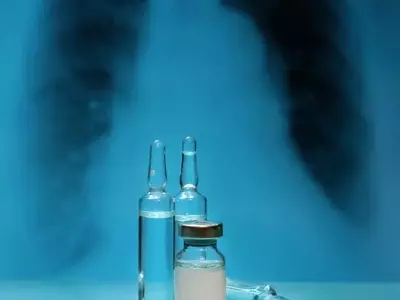 Connect Biopharma: Rademikibart & The Dupixent Challenge in Asthma/COPD