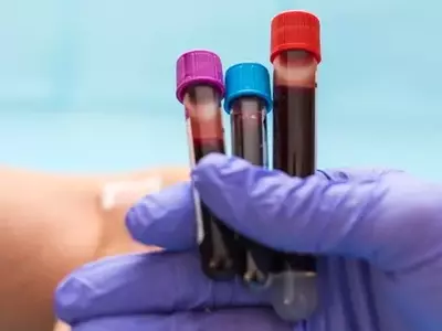 Guardant Health: High Growth, High Valuation, Uncertain Future